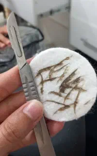 درما پلنینگ تخصصی بانوان
