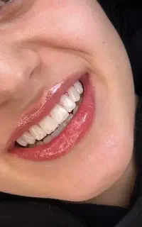 کامپوزیت و خدمات دندانپزشکی
