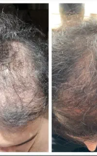 بازگشت اعتماد به نفس