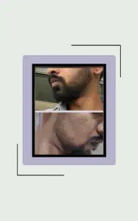 کاشت ممنوع آقا پسر