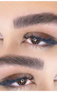 میکروبلیدینگ ابرو ،فیبروز،شیدلب،بن مژه،ریموو