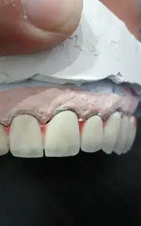 خدمات دندانسازی