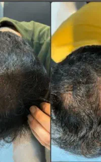 نمایندگی اصلی فروش محصولات ضد ریزش
