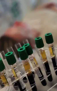 انجام تخصصی پی ار پی (prf) مزوتراپی.مرکزprp
