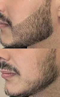 ریشو سیبیل پرپشت