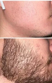 نتیجه‌ی واقعی درمانجو‌ها
