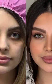 عمل جراحی بینی متخصص گوش،و حلق و بینی با 35تومن