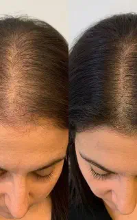 وقتشه با نانو کیت آشنا بشی