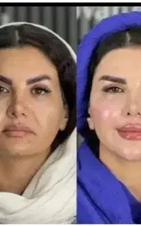 آخرین روز جشنواره تا امشب)فقط1/950با20خدمات رایگان