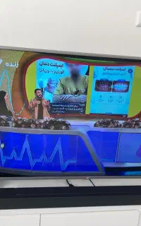 فروش تلویزیون ۵۰ اینچ ال جی LED