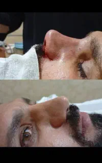 جراحی