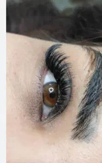 مدل کاشت هیدن کوی علوی