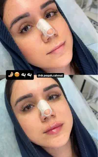 خدمات ژل،بوتاکس،مزوژل و پیرسینگ