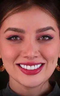 دندانپزشکی تخصصی کامپوزیت ، لمینت ، ایمپلنت اقساطی