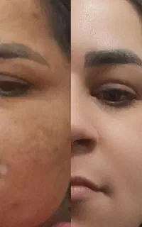 کرم روشن کننده و ضد لک