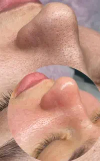 فیشال و پاکسازی پوست ویژه بانوان (با تخفیفات ویژه)
