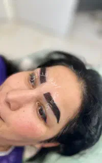 جشنواده میکروکاشت با ضمانت نامه +اقساط