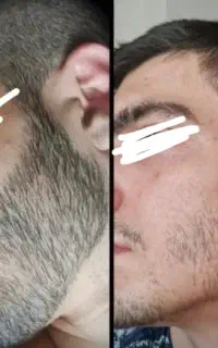 فوری پُرِش کُن