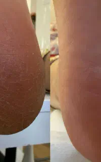 پدیکور اسپا