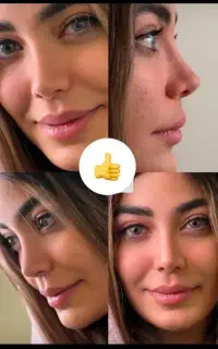 عمل جراحی بینی فقط 29.990/آفر ویژه