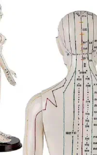 طب سوزنی،درمان میگرن و مشکلات گوارش و...