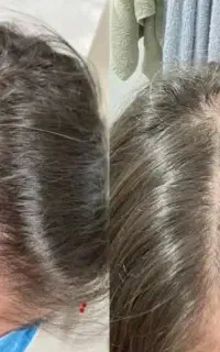 احیای ریشه غیر فعال