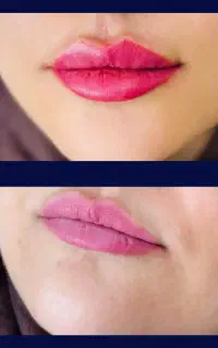 کلینیک زیبایی نُوا
