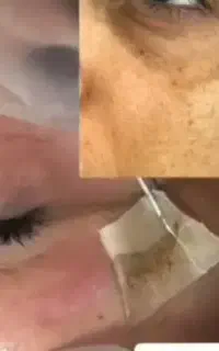آموزش حضوری ومجازی خدمات پوستی