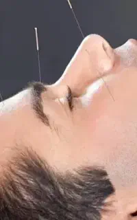 طب سوزنی تخصصی،حجامت،زالو درمانی،فصد،مزاج شناسی