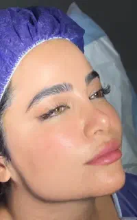جشنواره ساکشن غبغب توسط فوق تخصص جراح پلاستیک