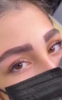 آف ویژه فیبروز ‌و میکروبلیدینگ فقط 900هزار
