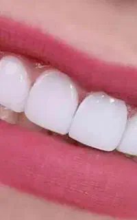 کلیه خدمات دندانپزشکی اقساطی با چک یا سفته