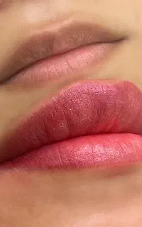 چرا مرکز تخصصی فیبروز هانیه جعفری