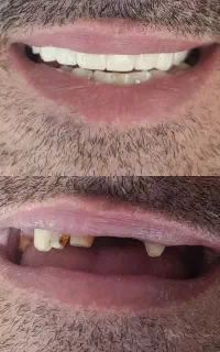 تخفیفات ویژه دندانپزشکی و دندانسازی