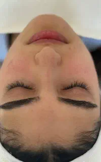 فشیال تکنیک پوست کره ای