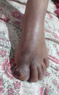 طب مفرد