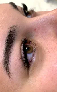 کاشت مژه هیدن