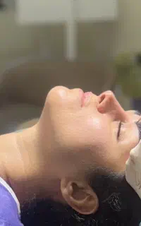 کاشت ابرو طبیعی / کاشت مو / پی ار پی/ مزوتراپی