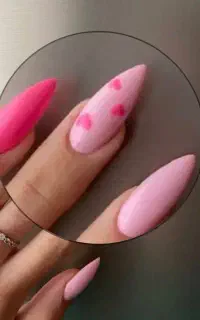 کاشت لمینت