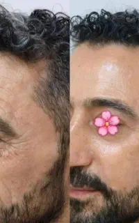 ۱۲ کاره بیوممتیک جوان کننده و روشن کننده پوست