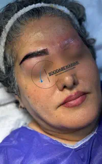 جشنواره ویژه مرکز کاشت ابرو