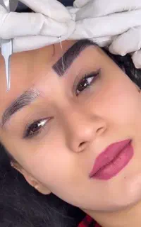 کاشت مو ابرو لیفت دایرکت ابرو افتادگی پلک بلفارو