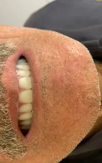 دندانسازی رز دنت