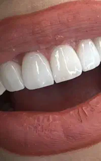 خدمات دندان پزشکی/شرایط اقساطی/۸ماهه