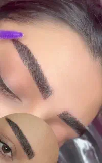 متخصص میکرووفیبروز