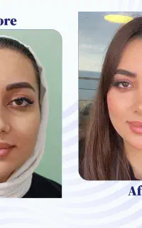 عمل بینی با شرایط ویژه (مشاوره رایگان)