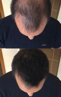 روش کاملا تضمینی