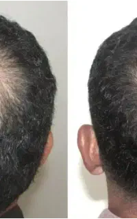 با راه طبیعی درمان شو