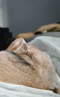 پاکسازی یا فیشیال پوست
