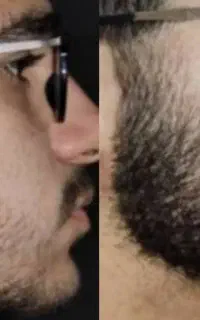 شکه ۳۰ روزه